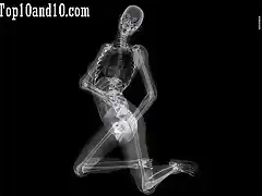 Sexy-models-under-X-ray-3