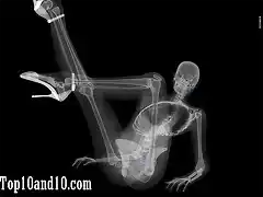 Sexy-models-under-X-ray-4