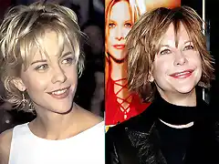 Meg-Ryan-Before-and-After-Plastic-Surgery