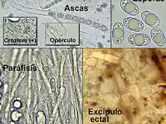 Helvella-sublicia-RM1165_Castroviejo_micro