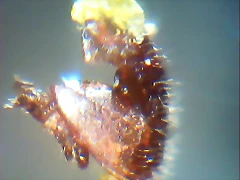 Varroa